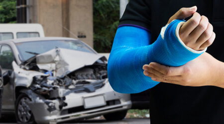 arm injury after car accident