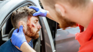 facial injuries and scarring