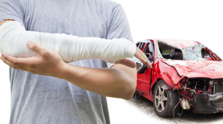 fractured arm after car accident