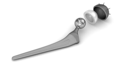 stryker hip implant