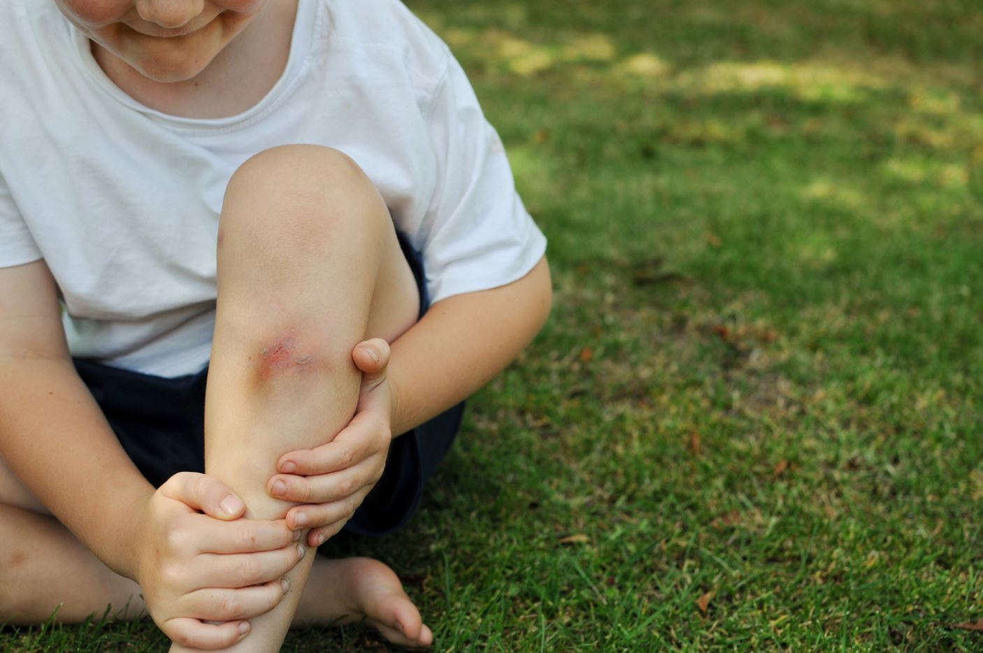 injured child's knee