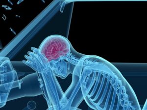 Brain-Injury due to accident