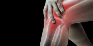 Person holding an inflamed knee highlighted in red, indicating joint pain or injury, possibly from an accident